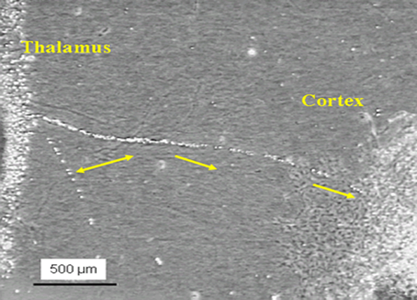 migrating from thalamus to the cortex